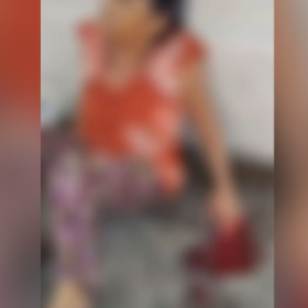 Divinópolis: Idosa ferida após tropeçar em cabos, quebrou o fêmur e ainda não teve dedos reimplantados