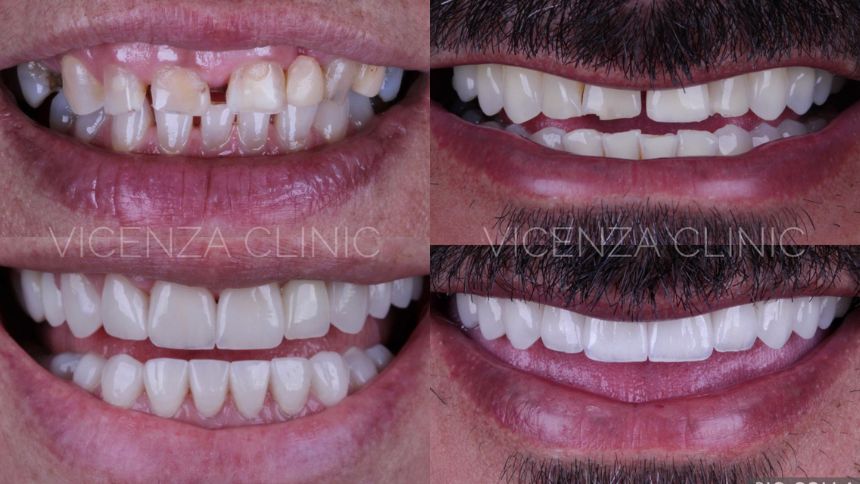 Clínica Vicenza: referência em tecnologia, estética e implantes dentários em Divinópolis