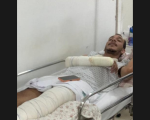 Após reportagem do Portal MPA, jovem que aguardava cirurgia há 18 dias consegue vaga em hospital de Luz