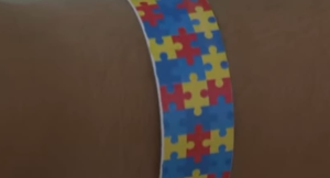 UPA de Divin&oacute;polis adota pulseiras para atendimento aos pacientes com autismo