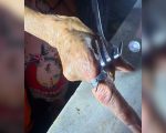 Mulher tenta retirar anel preso com auxílio de garfo e é atendida pelos Bombeiros em Formiga