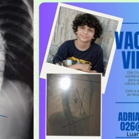 Divin&oacute;polis: Fam&iacute;lia faz vaquinha para ajudar menino com problema na coluna e pede apoio da popula&ccedil;&atilde;o