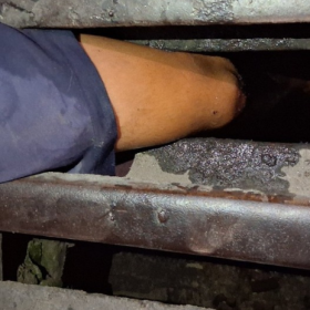 Criança é resgatada após ficar com perna presa em bueiro em Arcos