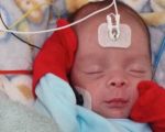 Hospital Regional João Penido, em Juiz de Fora, moderniza assistência neonatal com novos aparelhos de triagem auditiva