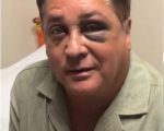 Cantor Leonardo sofre acidente em pescaria