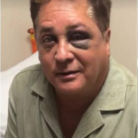 Cantor Leonardo sofre acidente em pescaria