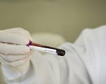 Governo de Minas passa a disponibilizar resultados de exames dos doadores de sangue no MG App