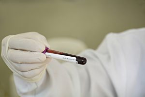 Governo de Minas passa a disponibilizar resultados de exames dos doadores de sangue no MG App