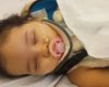 Mãe e filha feridas em grave acidente na MG-050 mobilizam vaquinha para tratamento