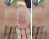 Pai é preso suspeito de torturar filhos com comida fervendo na Grande BH
