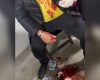 Veja o vídeo: Denúncia aponta vereador como autor de agressão e lesão corporal em Divinópolis