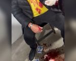 Veja o vídeo: Denúncia aponta vereador como autor de agressão e lesão corporal em Divinópolis