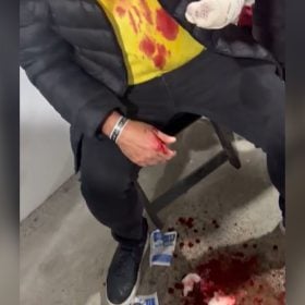 Veja o vídeo: Denúncia aponta vereador como autor de agressão e lesão corporal em Divinópolis