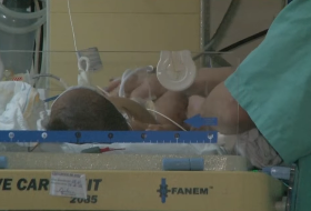 Entrevista: Casos de doenças respiratórias acendem alerta em Divinópolis