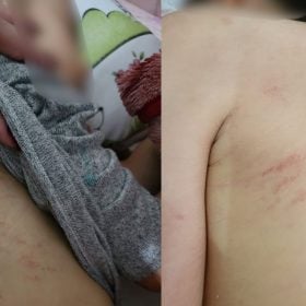 Família denuncia ferimentos em criança autista de escola de educação especial em Divinópolis