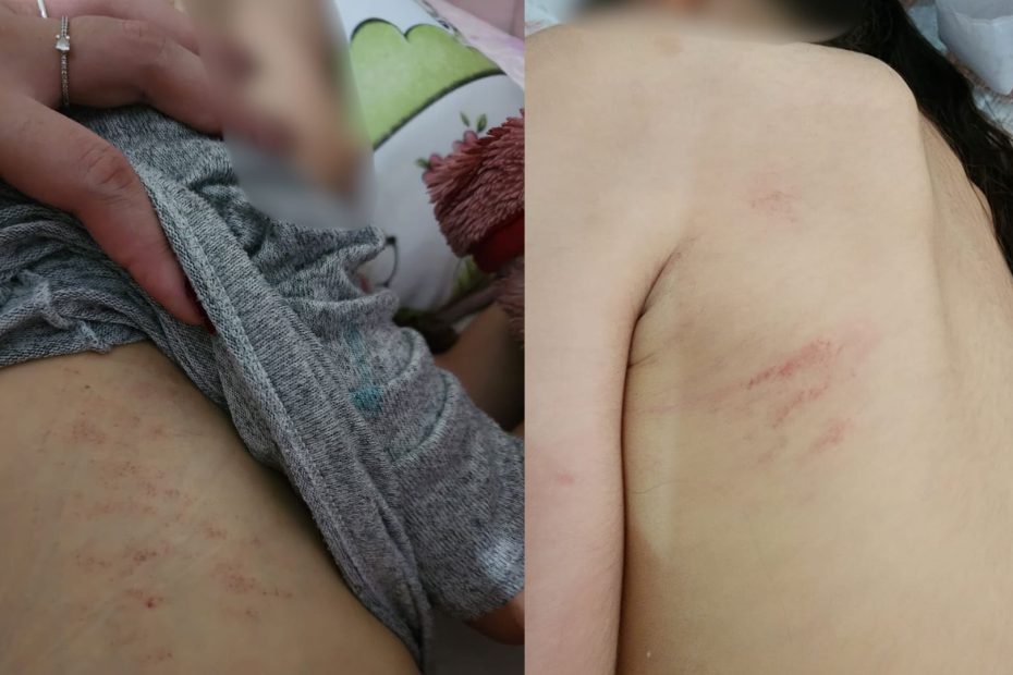 Família denuncia ferimentos em criança autista de escola de educação especial em Divinópolis
