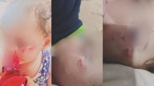 Mãe faz BO contra escola após filha ser mordida por colega em Divinópolis: 'Não pode ser normal'