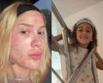 Karoline Lima revela rosto após procedimento estético e filha sugere maquiagem para disfarçar vermelhidão
