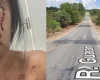 Moradora sofre acidente no Complexo da Ferradura e cobra sinalização em Divinópolis