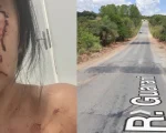 Moradora sofre acidente no Complexo da Ferradura e cobra sinaliza&ccedil;&atilde;o em Divin&oacute;polis