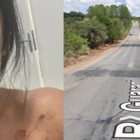 Moradora sofre acidente no Complexo da Ferradura e cobra sinalização em Divinópolis