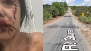 Moradora sofre acidente no Complexo da Ferradura e cobra sinalização em Divinópolis