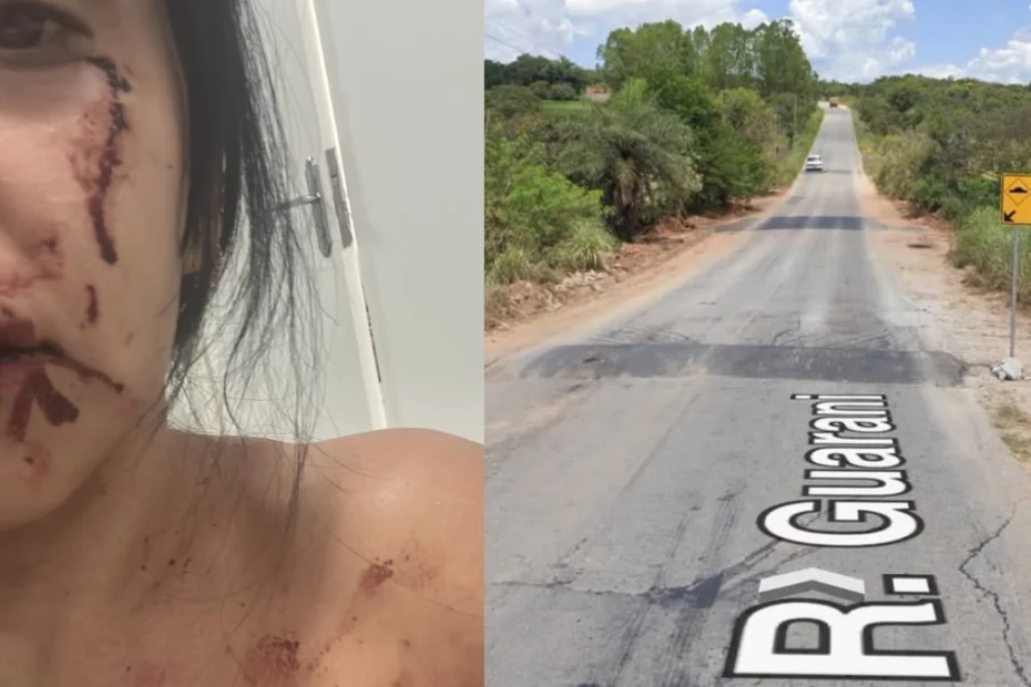 Moradora sofre acidente no Complexo da Ferradura e cobra sinalização em Divinópolis