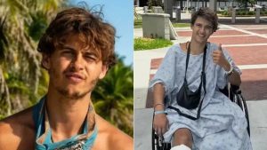 Ex-participante do Survivor na Grécia processa produtores do programa por acidente que resultou na amputação de uma perna