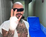 Influenciador digital perde dedo ao tentar invadir área não autorizada do Rock in Rio