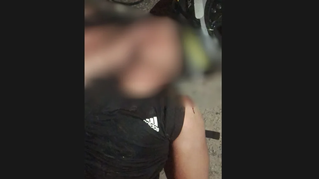 Atendimento do SAMU a homem ferido ap&oacute;s queda de moto em Divin&oacute;polis
