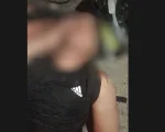 Atendimento do SAMU a homem ferido ap&oacute;s queda de moto em Divin&oacute;polis