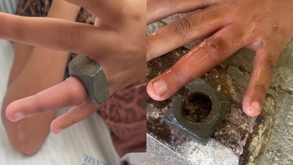 Crian&ccedil;a fica com porca presa no dedo e &eacute; socorrida pelos bombeiros em Bambu&iacute;