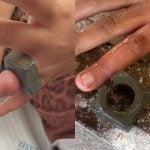 Crian&ccedil;a fica com porca presa no dedo e &eacute; socorrida pelos bombeiros em Bambu&iacute;