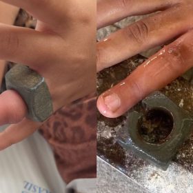 Crian&ccedil;a fica com porca presa no dedo e &eacute; socorrida pelos bombeiros em Bambu&iacute;