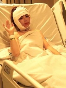 Manu Bahtidão revela que passou por cirurgia estética no rosto e aprova resultado inicial
