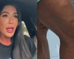 Gracyanne Barbosa revela joelho inchado e dificuldades ap&oacute;s les&atilde;o no Dan&ccedil;a dos Famosos